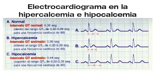 En que consiste un electrocardiograma